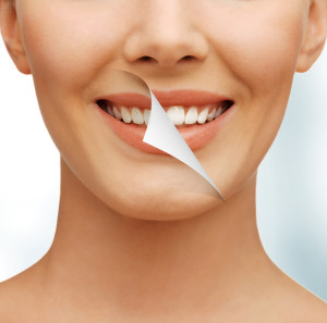чистка и отбеливание зубов