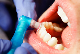 Последствия несоблюдения гигиены полости рта
